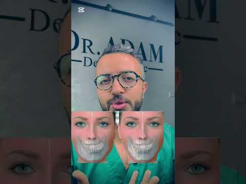 Dental video thumbnail