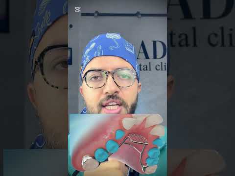 Dental video thumbnail