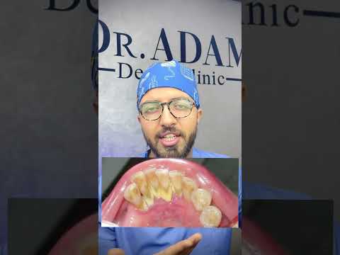 Dental video thumbnail